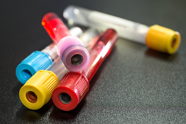 A collection of blood bottles